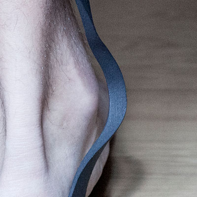 3D-printed custom orthotics with complex generative design