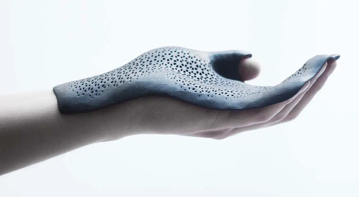 3D printed generative and bespoke orthoses made in collaboration with Mhox